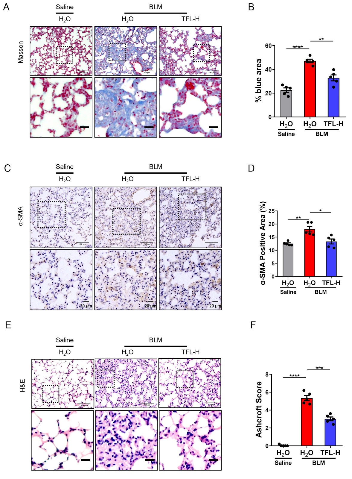 Total flavonoids of litchi seed attenuates cellular senescence by inhibiting the production of SASP through p65 suppression and ameliorates pulmonary fibrosis