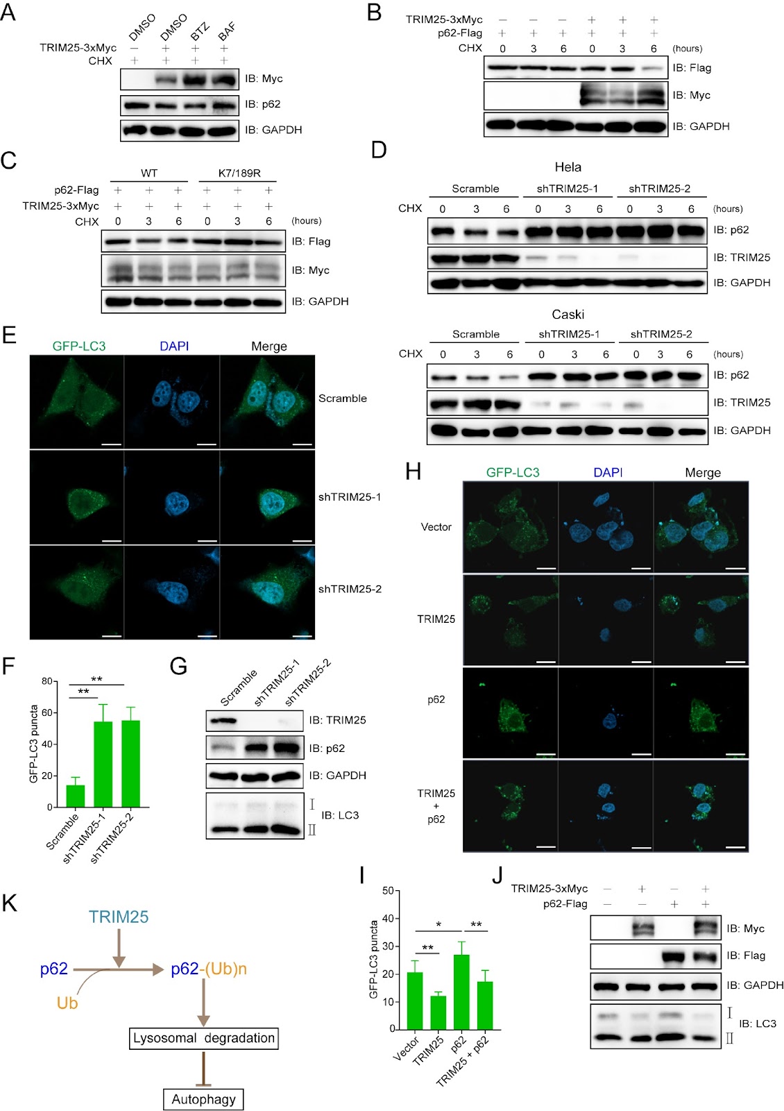 TRIM25 ubiquitinates and degrades p62/SQSTM1 to suppress autophagy