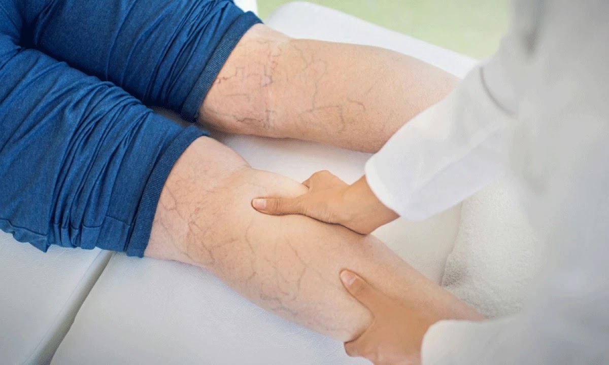 Especialidades médicas con mayor demanda: el crecimiento de la flebología vascular