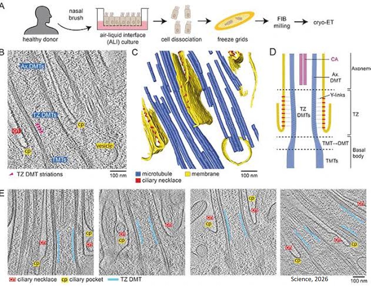 Gene defects linked to primary ciliary dyskinesia