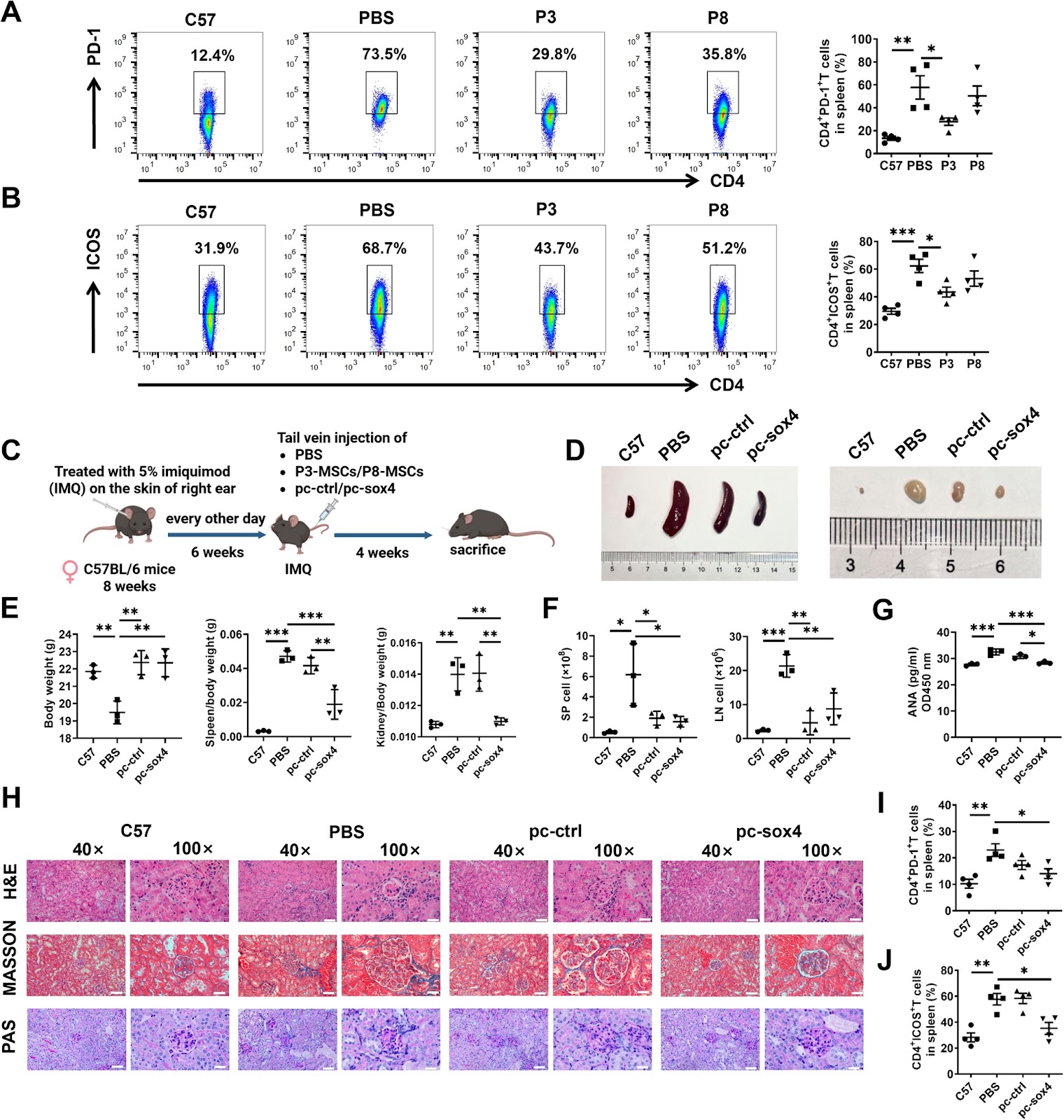 Overexpression of SOX4 in MSCs inhibits cellular senescence and enhances therapeutic efficacy in systemic lupus erythematosus