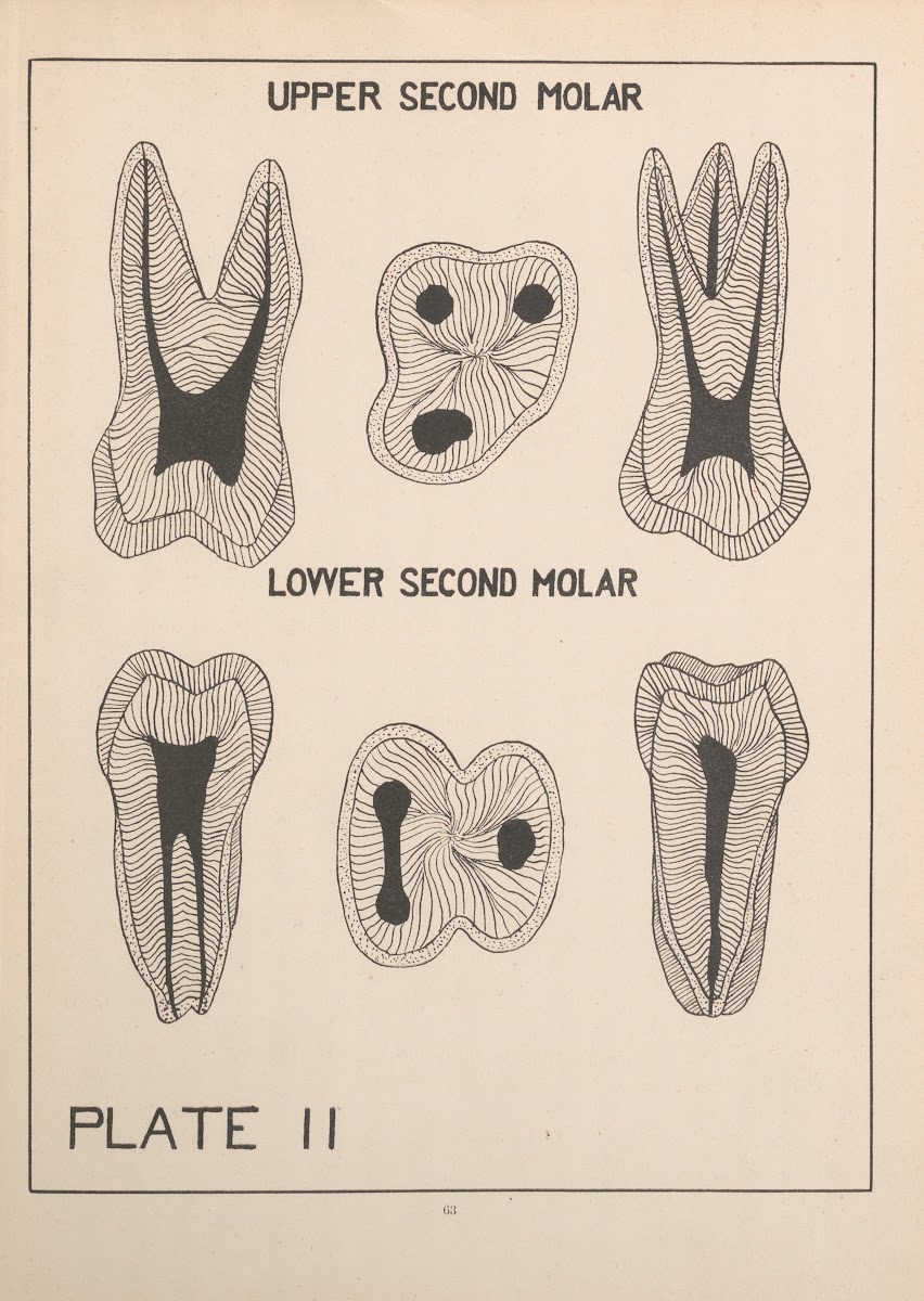 Upper And Lower Second Molar 1924