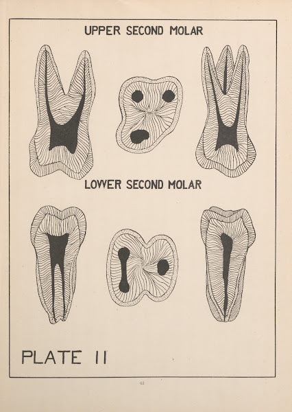 Upper And Lower Second Molar 1924