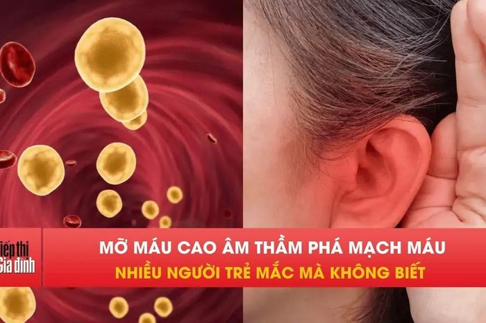 Dấu hiệu trên mắt cảnh báo mỡ máu cao cực nguy hiểm - Tạp chí Tiếp thị &amp; Gia đình