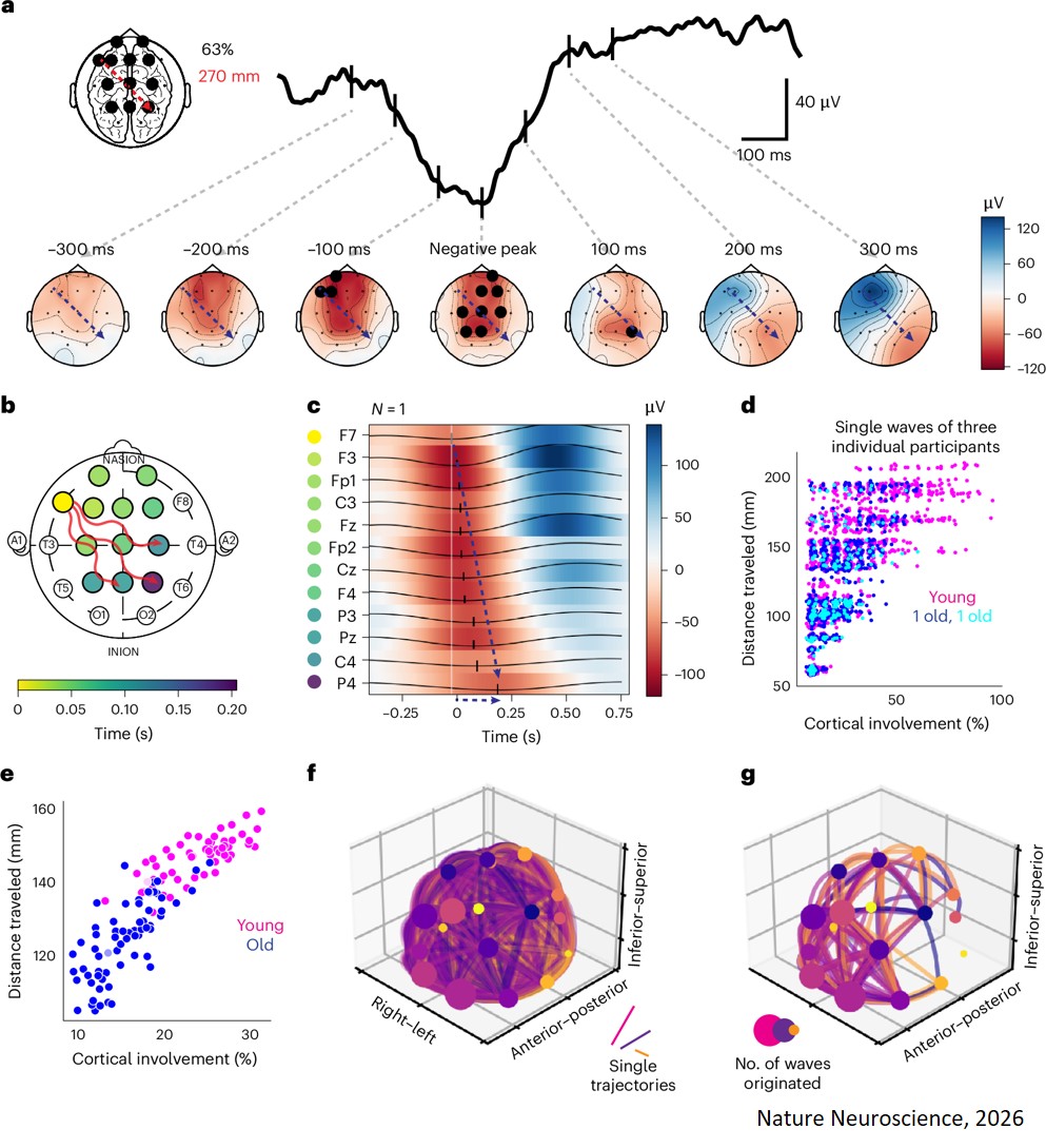 Linking deep-sleep loss to Alzheimer’s-related protein buildup