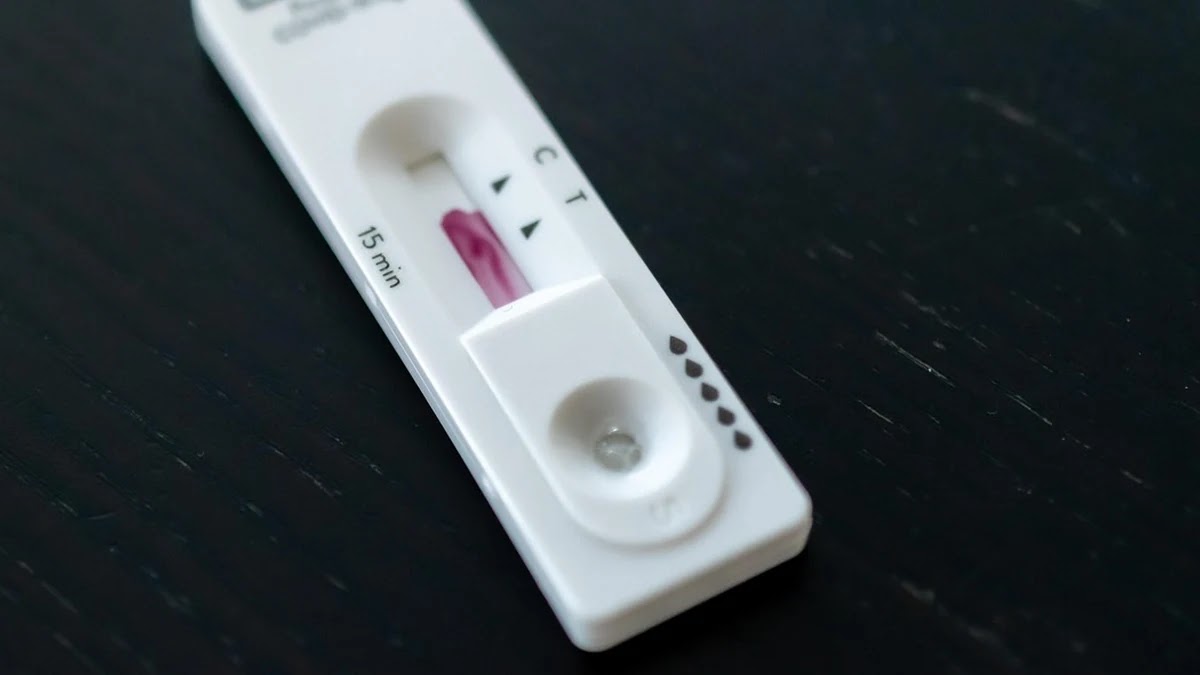 건강검진 주요 수치별 간 기능 이상 초기 진단 기준