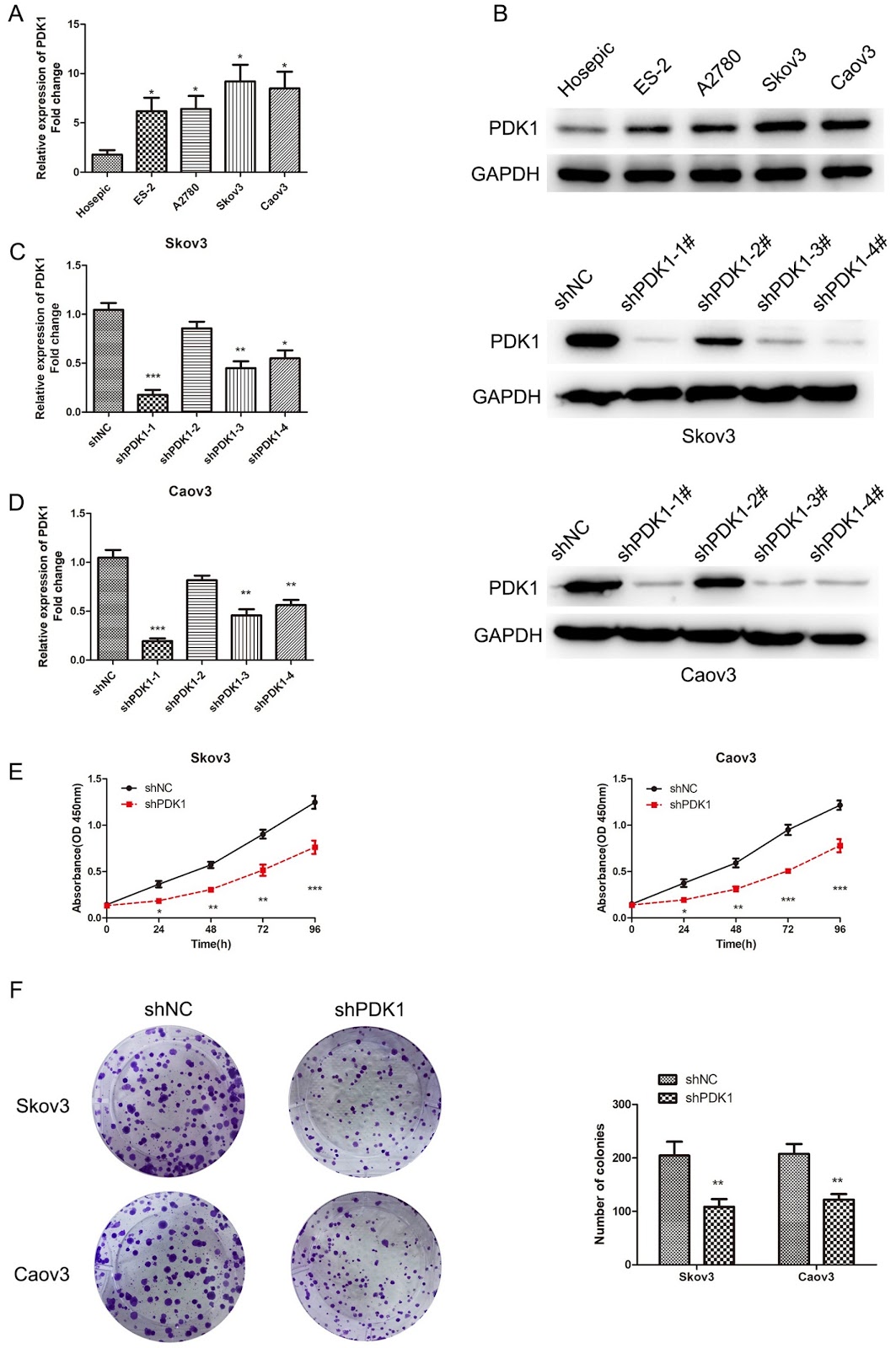 PDK1 promotes epithelial ovarian cancer progression by upregulating BGN