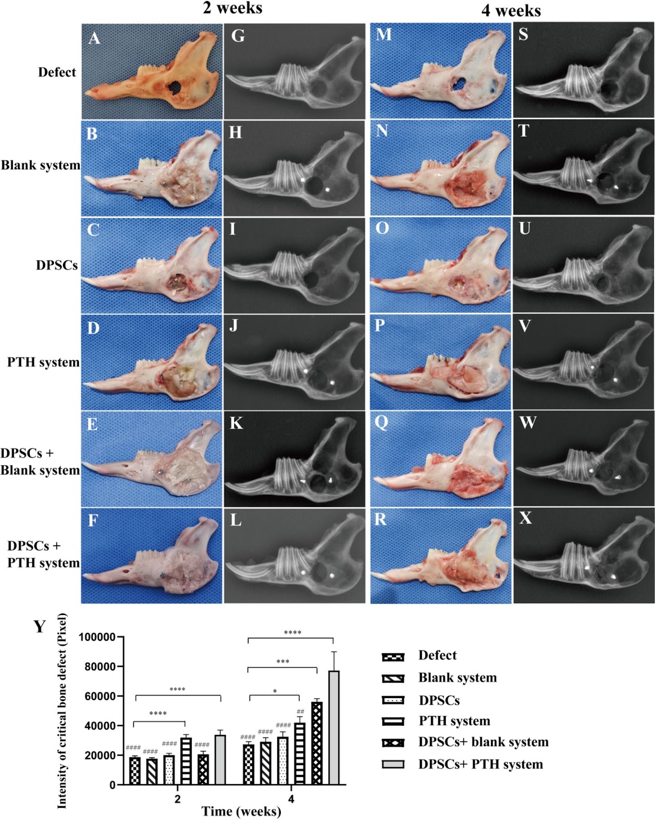 The local pulsatile parathyroid hormone delivery system induces the osteogenic differentiation of dental pulp mesenchymal stem cells to reconstruct mandibular defects