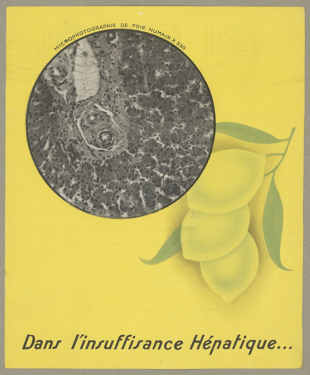 Dans linsuffisance hépatique 1910 1950