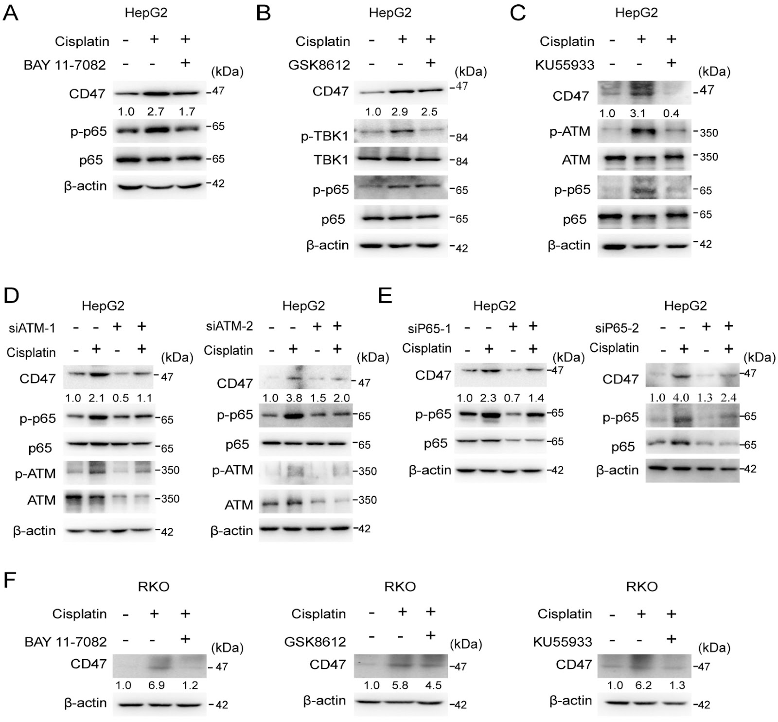 CD47 blockade enhances cisplatin sensitivity by inhibiting DNA repair gene expression