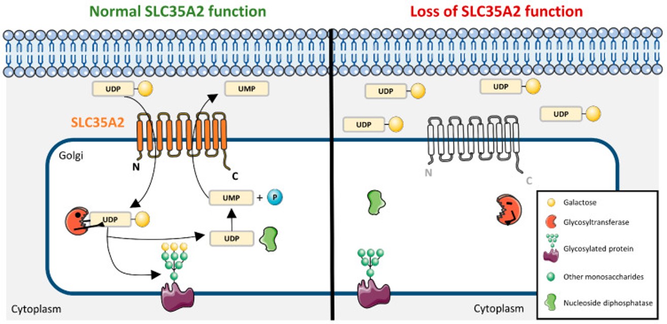 Multi-Omic Evaluation of Glycosylation Restoration Therapy in SLC35A2-CDG
