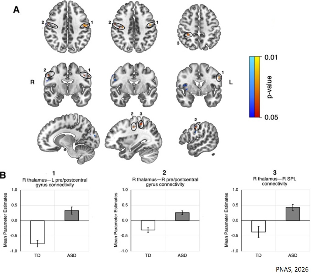 Brains of teens with autism ‘tune in’ less to unfamiliar voices
