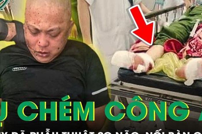 Đại úy công an bị chém tại trụ sở đã được nối lại bàn chân và phẫu thuật sọ não - Báo Sức Khỏe &amp; Đời Sống