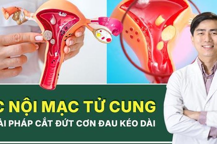 Tăng cường chăm sóc sức khỏe cho phụ nữ mắc bệnh lạc nội mạc tử cung trong bối cảnh mới - Báo Sức Khỏe &amp; Đời Sống