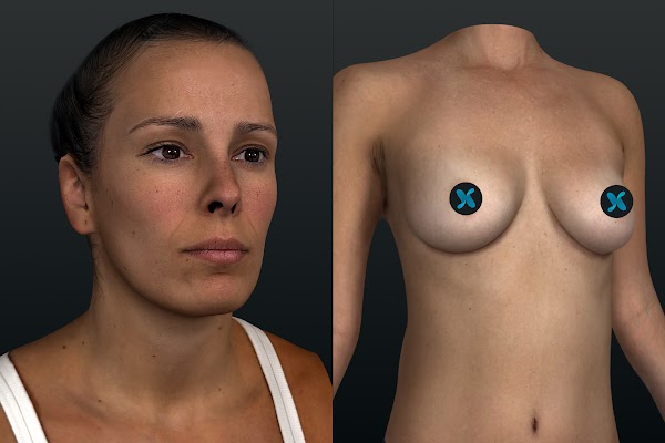 Visage et poitrine 3D générés avec Crisalix.