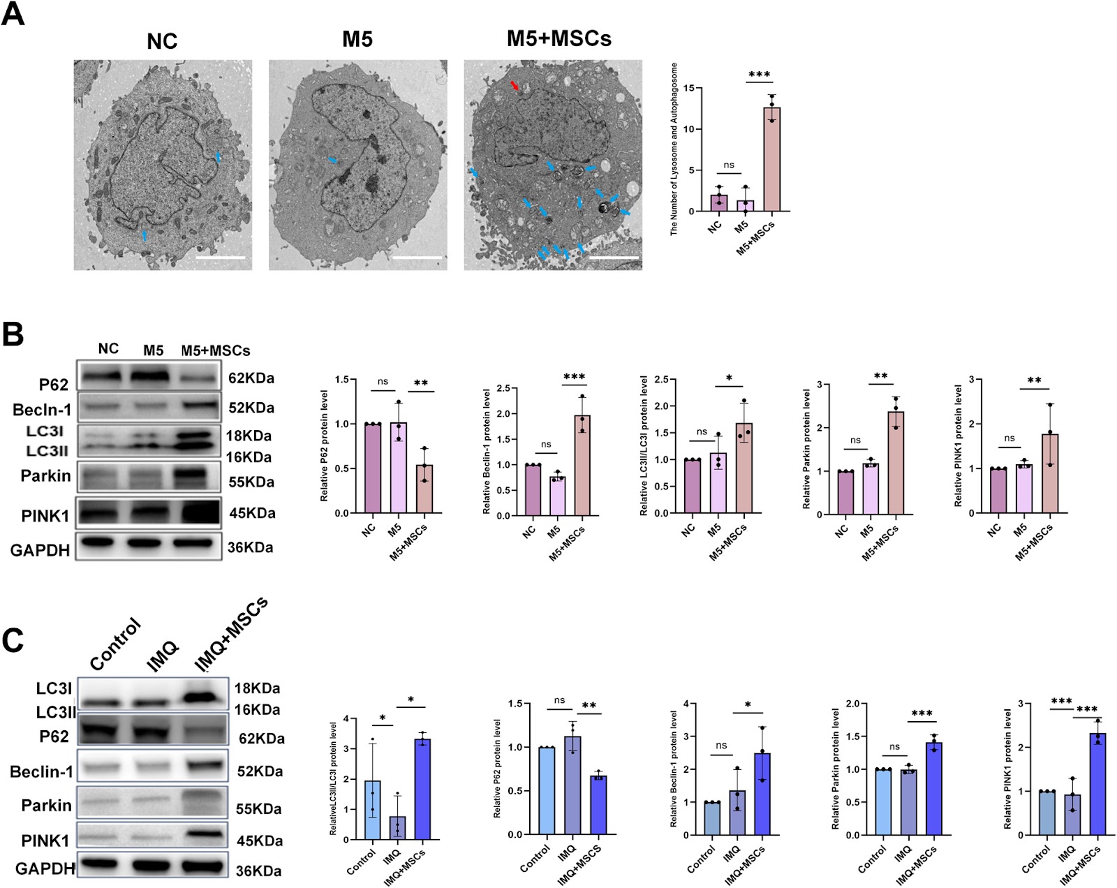 Research based on serine metabolism indicates mesenchymal stem cells alleviate psoriasis by regulating the PSPH-PINK1-Parkin-NLRP3 pathway in HaCaT