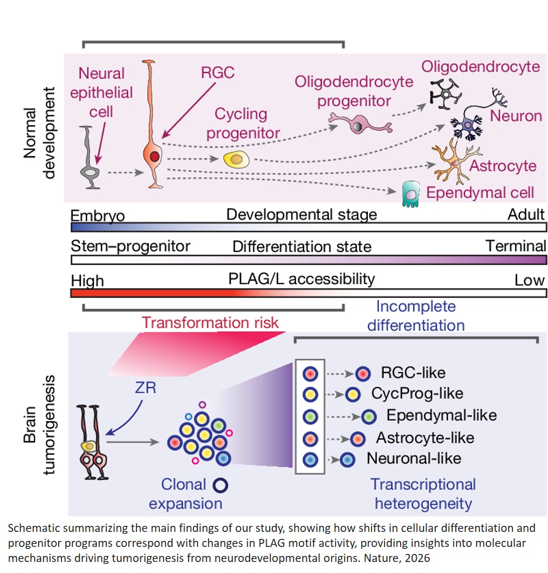 Dominant clones leverage developmental epigenomic states to drive ependymoma