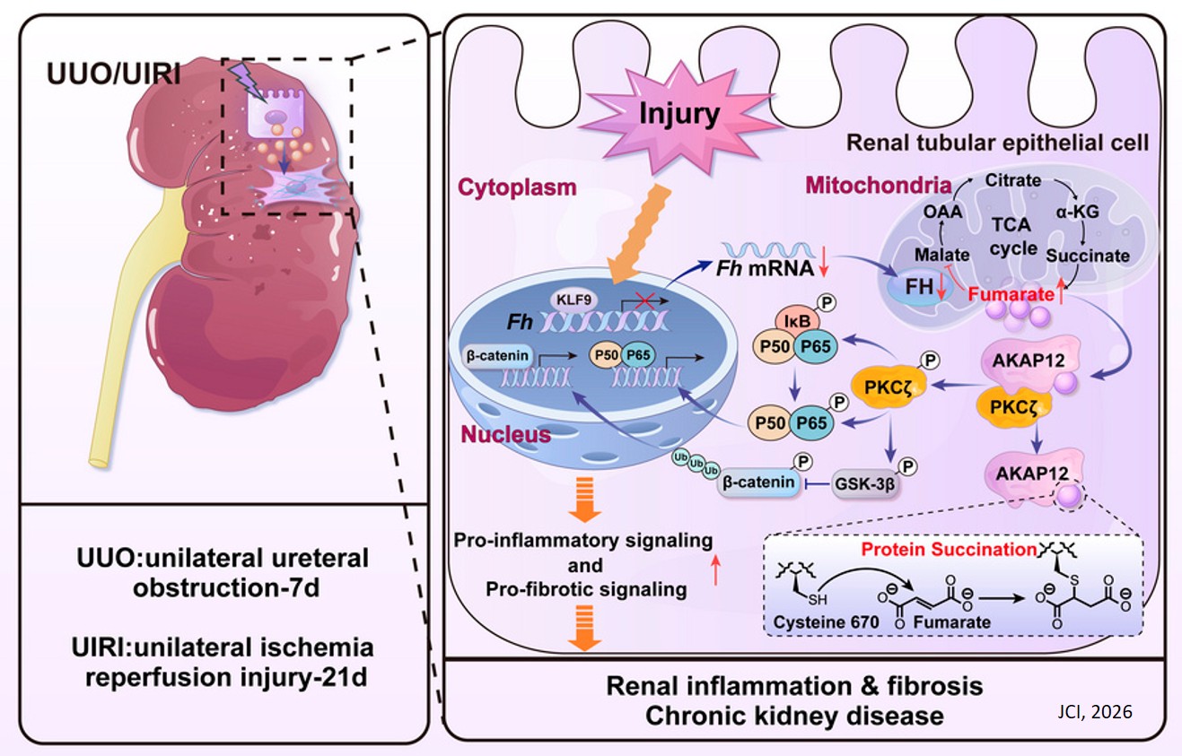 Fumarate-induced succination of A-kinase anchor protein 12 exacerbates renal inflammation and fibrosis