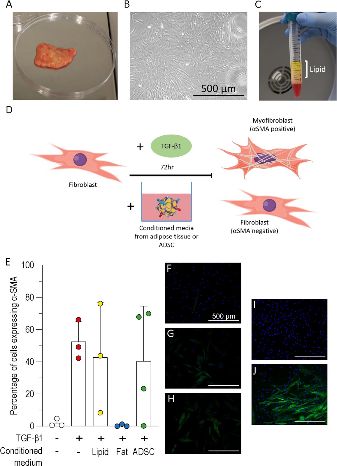 Inhibition and reversal of a TGF‑β1 induced myofibroblast phenotype by adipose tissue‑derived paracrine factors