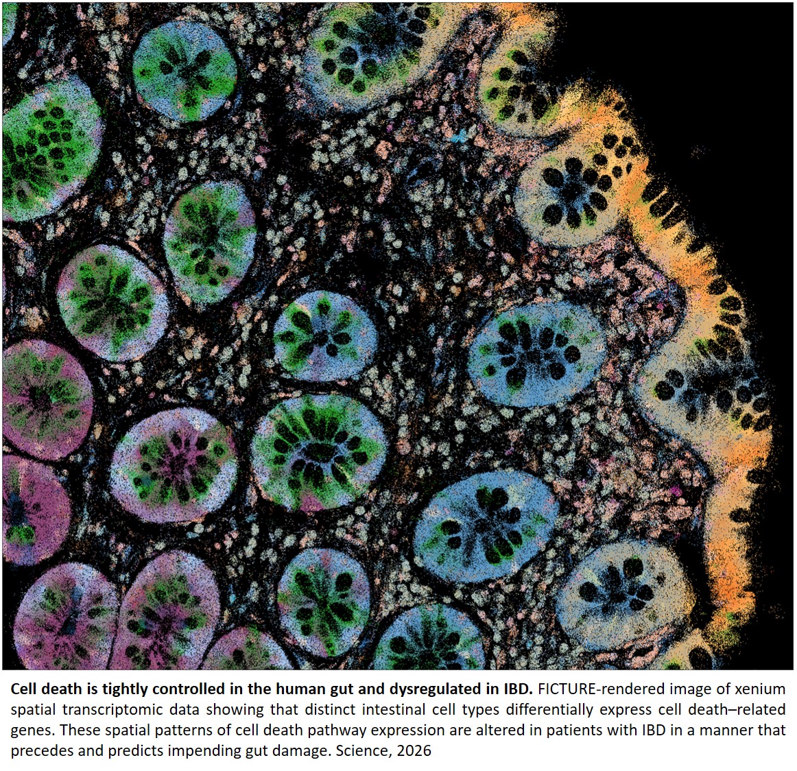 A necroptotic-to-apoptotic signaling axis underlies inflammatory bowel disease