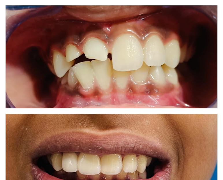 Patient Smile Transformation 2