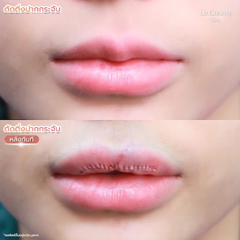 รีวิวตกแต่งริมฝีปาก — ตกแต่งริมฝีปาก