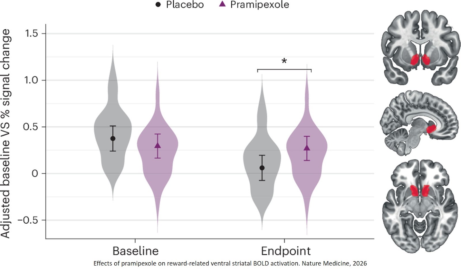 Efficacy and target engagement of dopamine agonist pramipexole for anhedonic depression: a randomized placebo-controlled trial