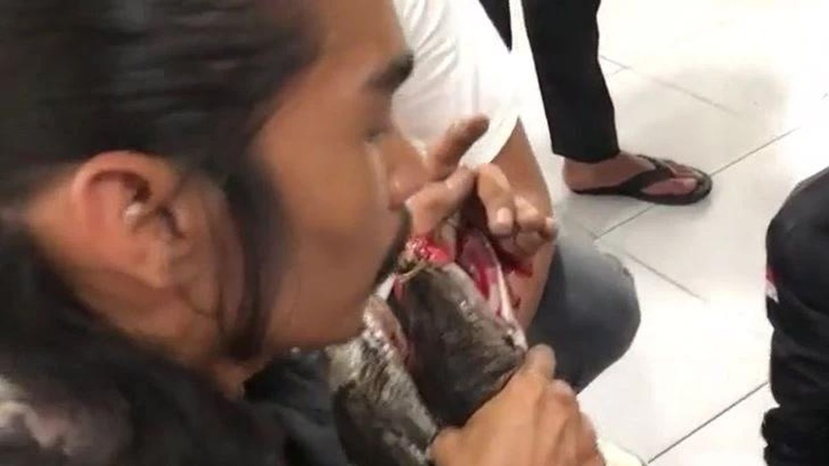 Chuyên gia bắt rắn bị trăn khổng lồ ngoạm chặt tay, phải nhập viện cấp cứu - Tạp chí Doanh Nghiệp Việt Nam