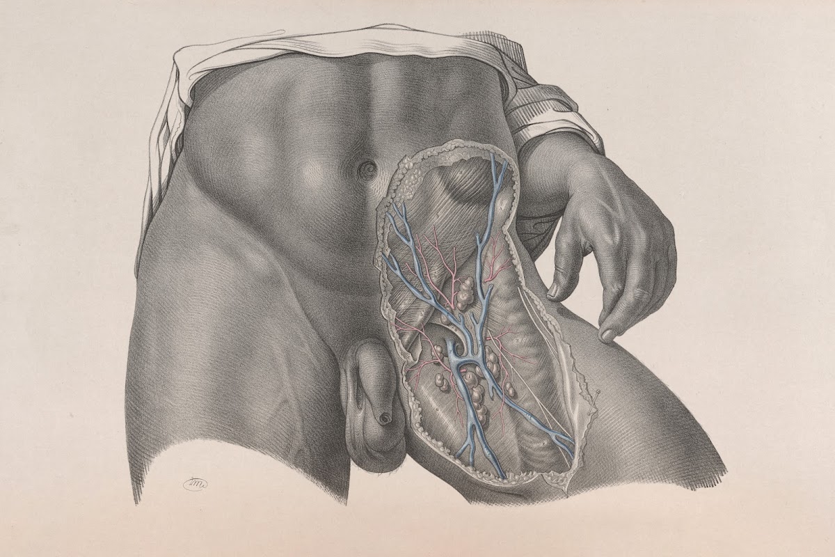 Surgical anatomy Pl26 1856