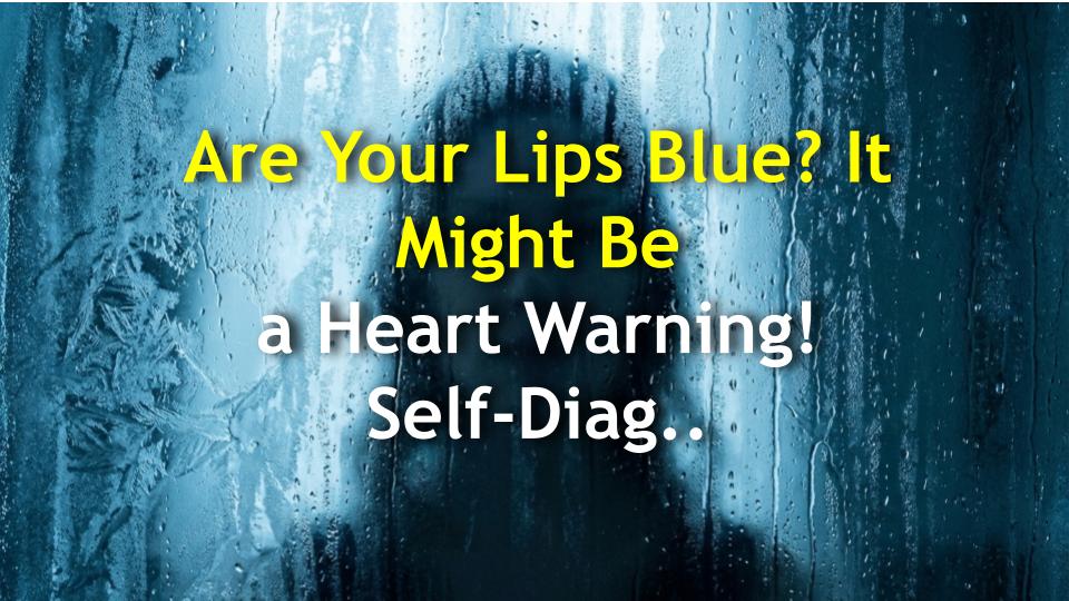 Are Your Lips Blue? It Might Be a Heart Warning! Self-Diagnosis & Fixes