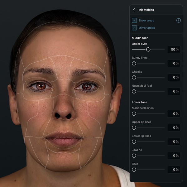 Simulation faciale 3D dans l’application Crisalix avec l’outil de procédure « Injectables » ouvert. 1080px x 1080px.