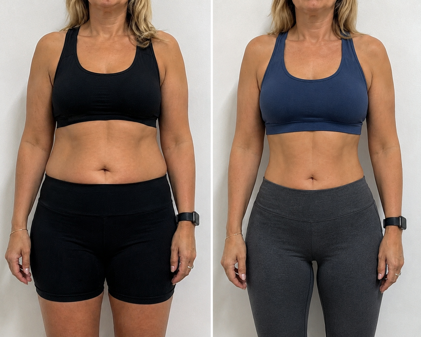 Transformación Silvia T. Antes y Después