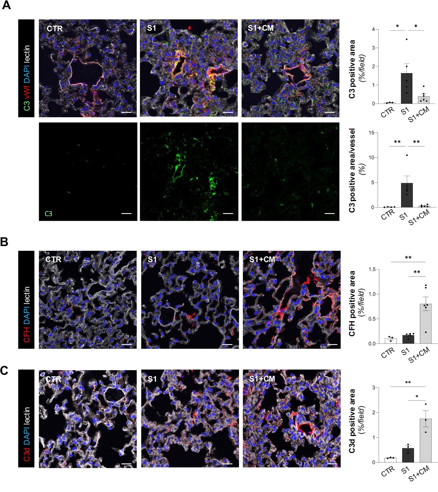 Mesenchymal stromal cell secretome reduces lung injury and thrombo-inflammation induced by SARS-CoV-2 spike protein