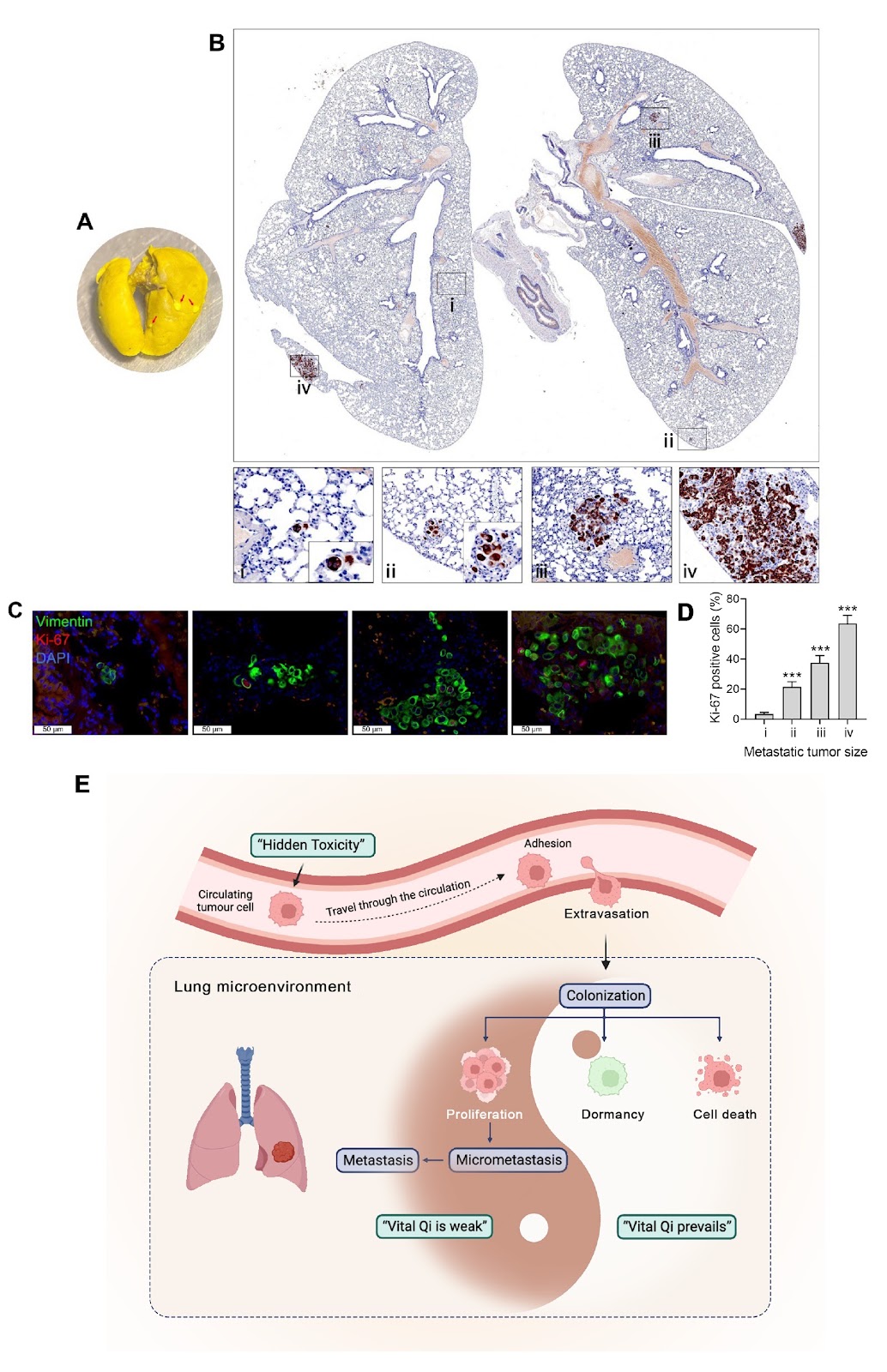 Lung metastases formed by disseminated tumor cells exhibit different proliferation states