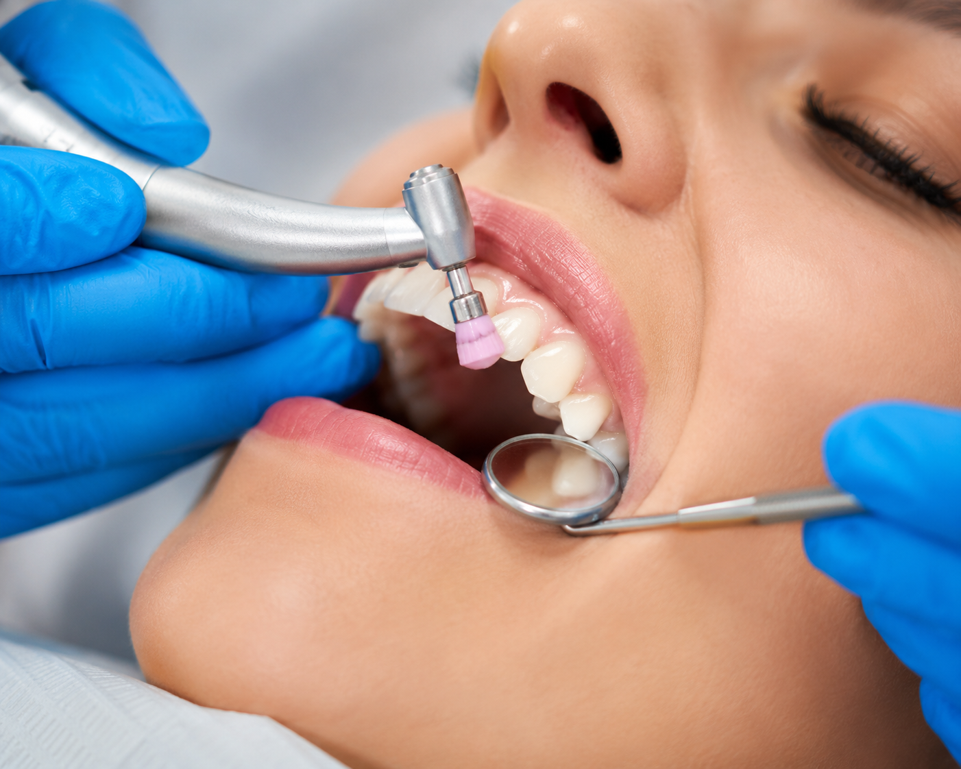 Oral cleaning and plaque removal polishing