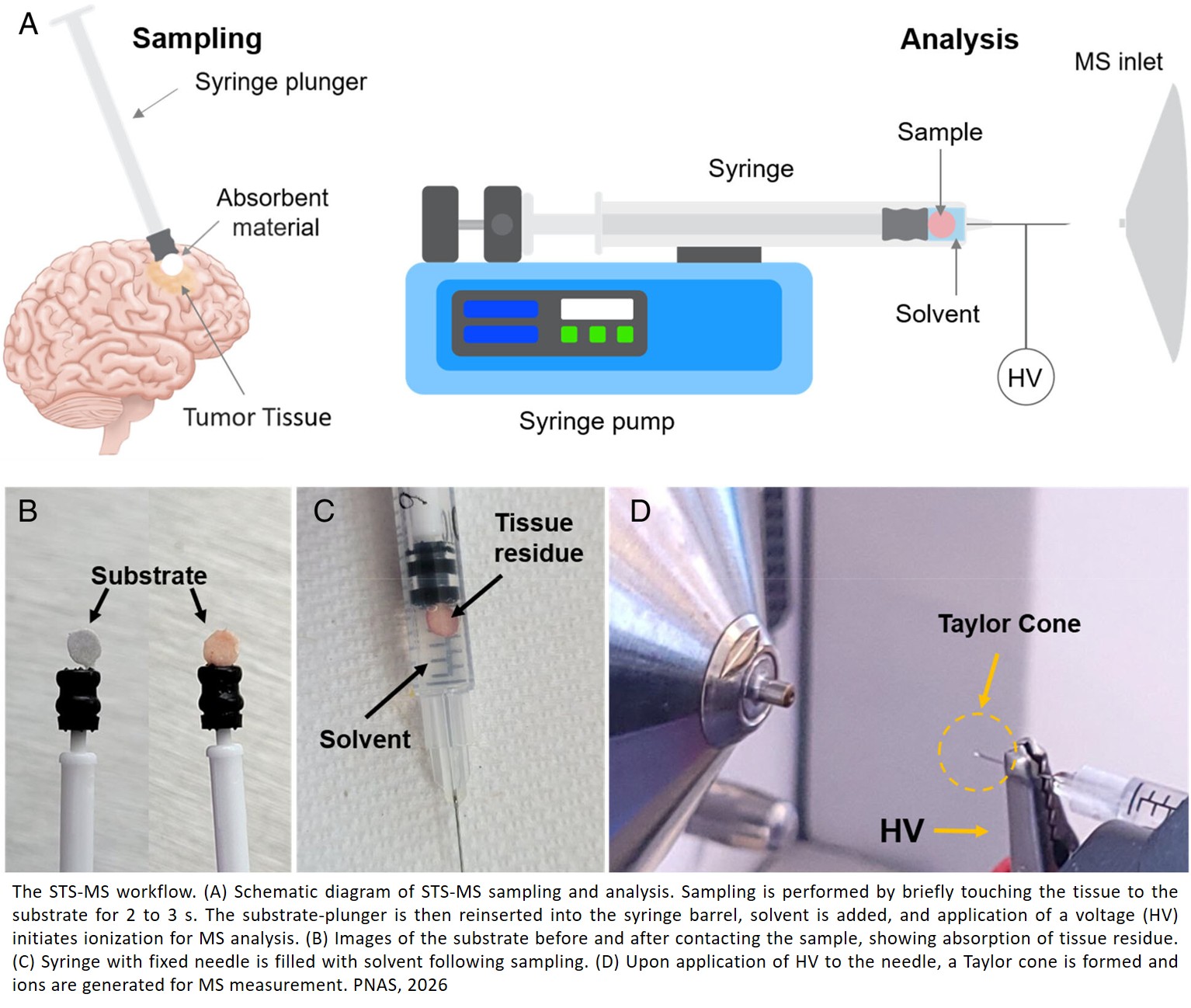 Metabolite ratiomics: Rapid diagnosis and classification of gliomas for intraoperative application during brain surgery