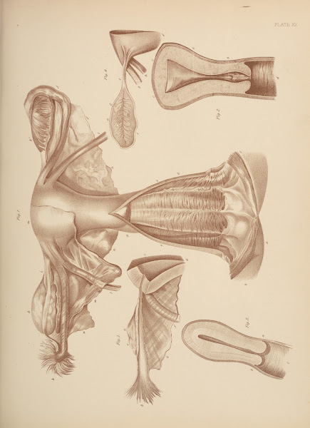 Genital Organs of an Adult Woman presenting different Sections exhibiting the Ex