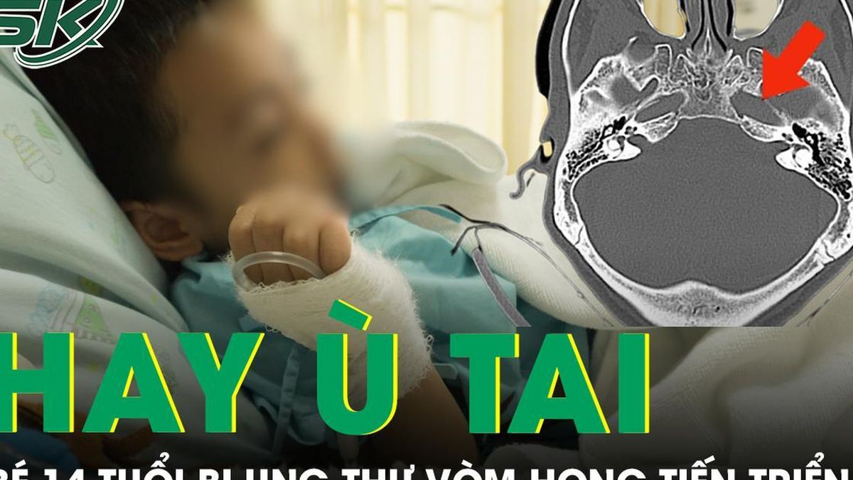 Bé trai 14 tuổi liên tục ù tai, bác sĩ phát hiện ung thư vòm mũi họng giai đoạn tiến triển - Báo Sức Khỏe &amp; Đời Sống