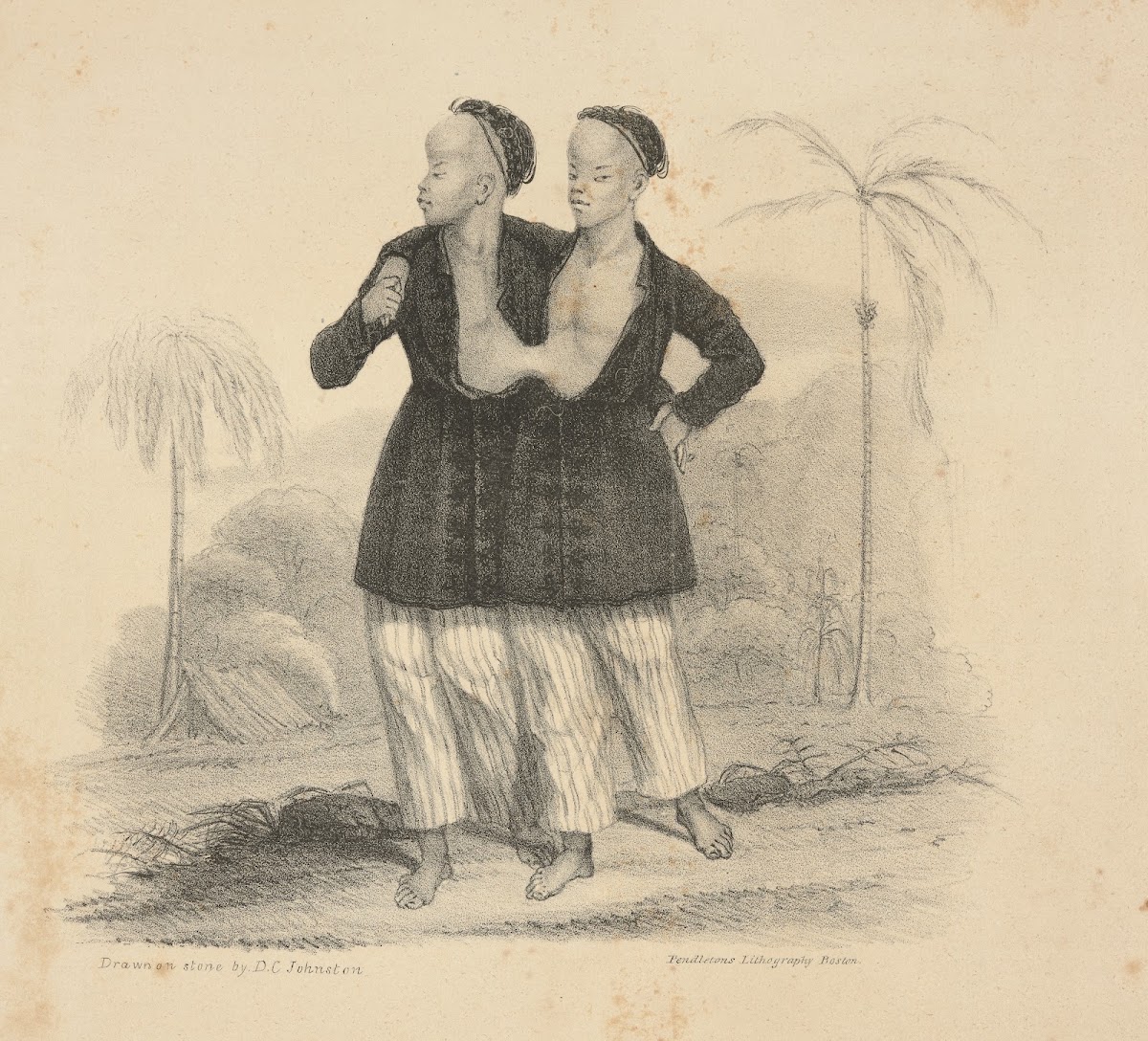 The Siamese boys Aged 18 1829