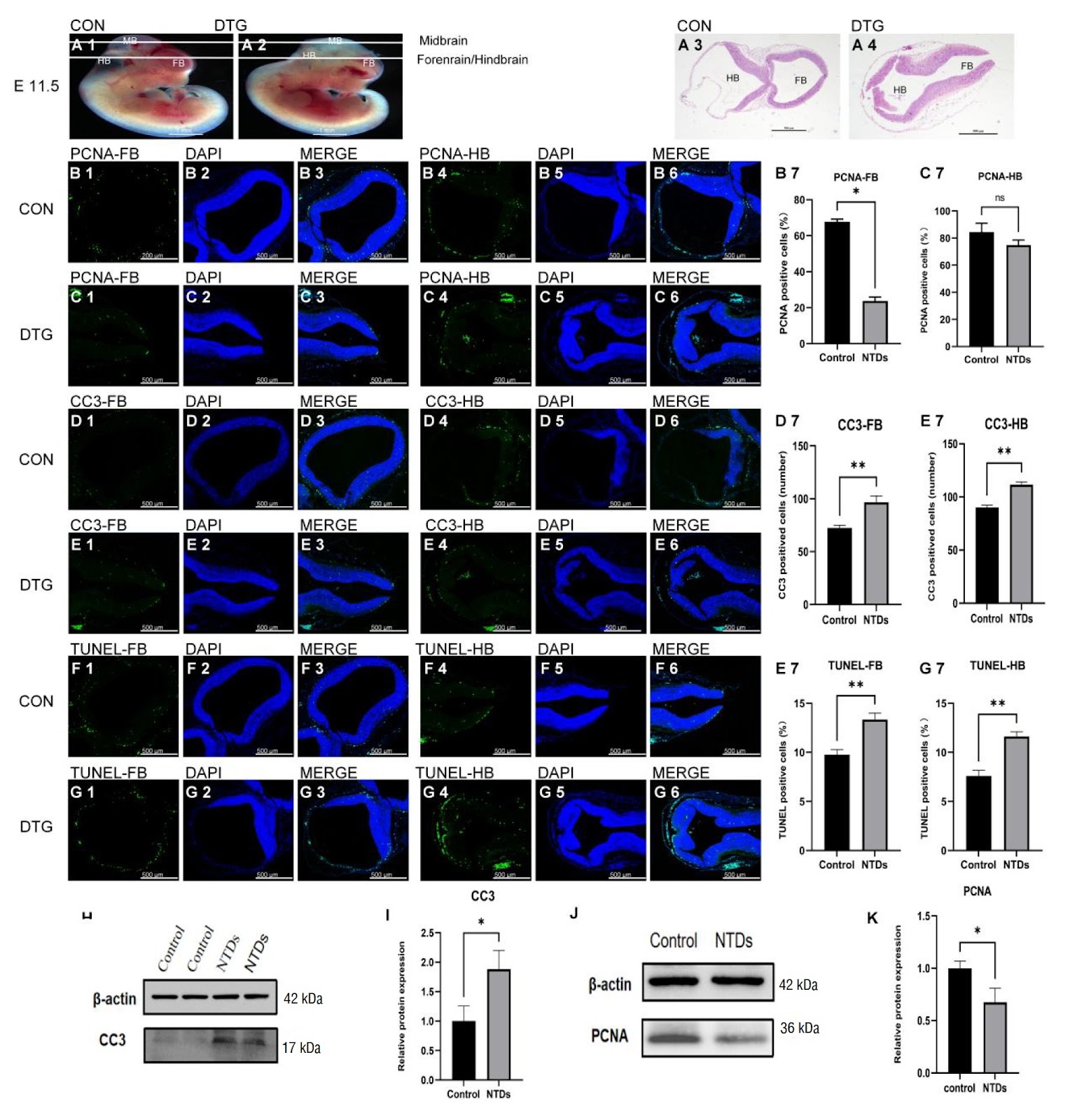 Combined ex vivo and in vivo evaluation of dolutegravir embryotoxicity: NTDs and yolk sac vascular abnormalities