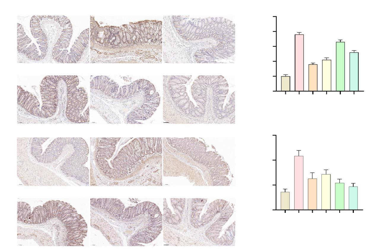 Mechanism of Schisandrin B in Alleviating Pyroptosis of Epithelial Cells in Rats with Ulcerative Colitis Based on Regulation of NLRP3/Caspase-1/GSDMD Signaling Pathway by Autophagy