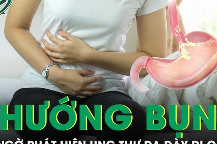 Chướng bụng kéo dài, người phụ nữ 48 tuổi bất ngờ phát hiện ung thư dạ dày di căn - Báo Sức Khỏe &amp; Đời Sống