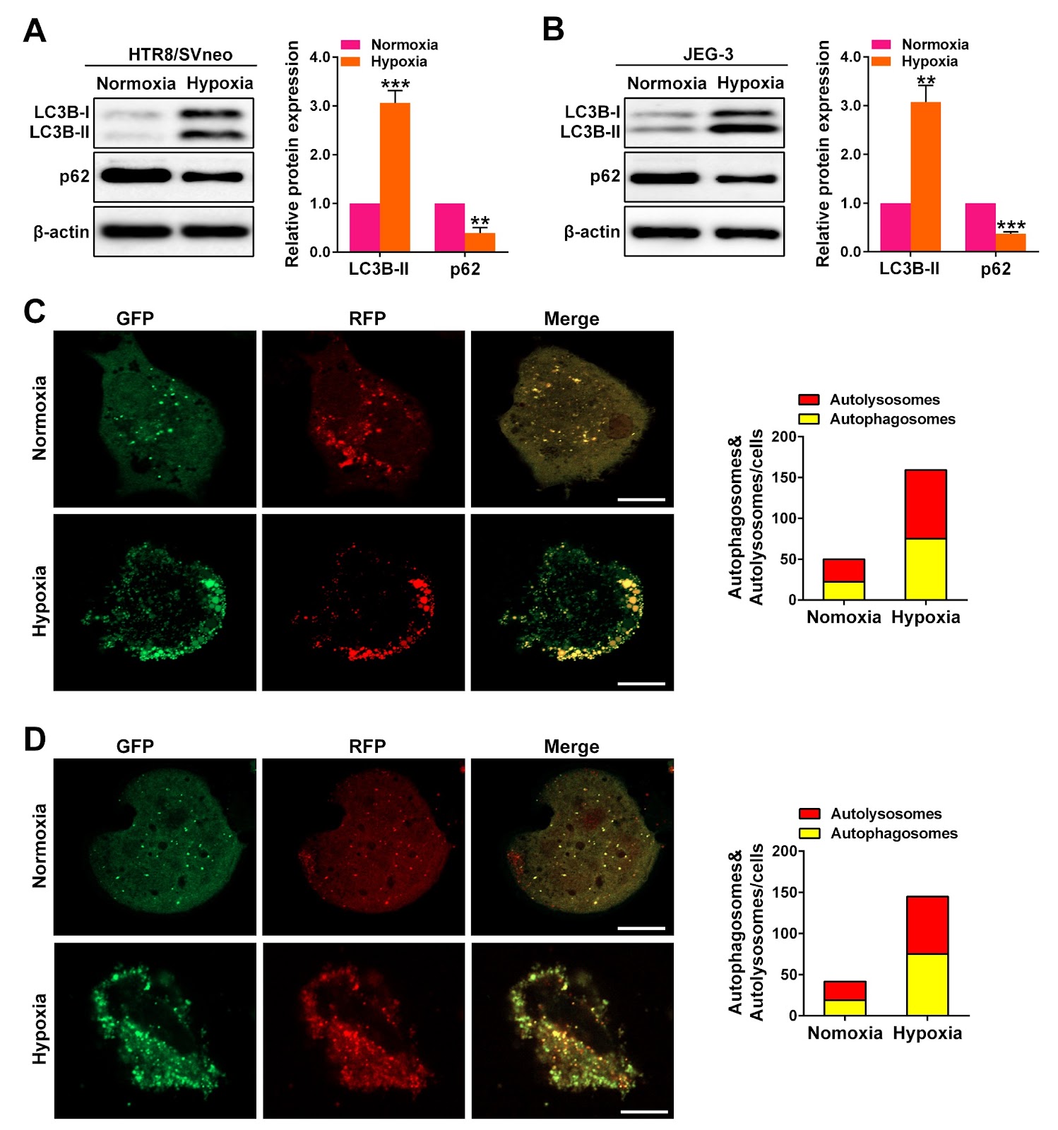Inhibition of autophagy via 3-methyladenine alleviates the progression of preeclampsia