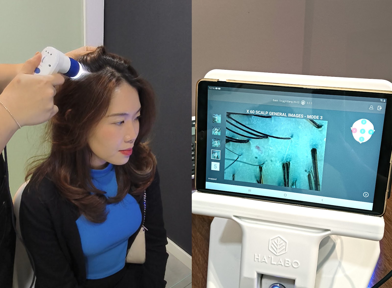 Scalp Analysis at Ha'Labo