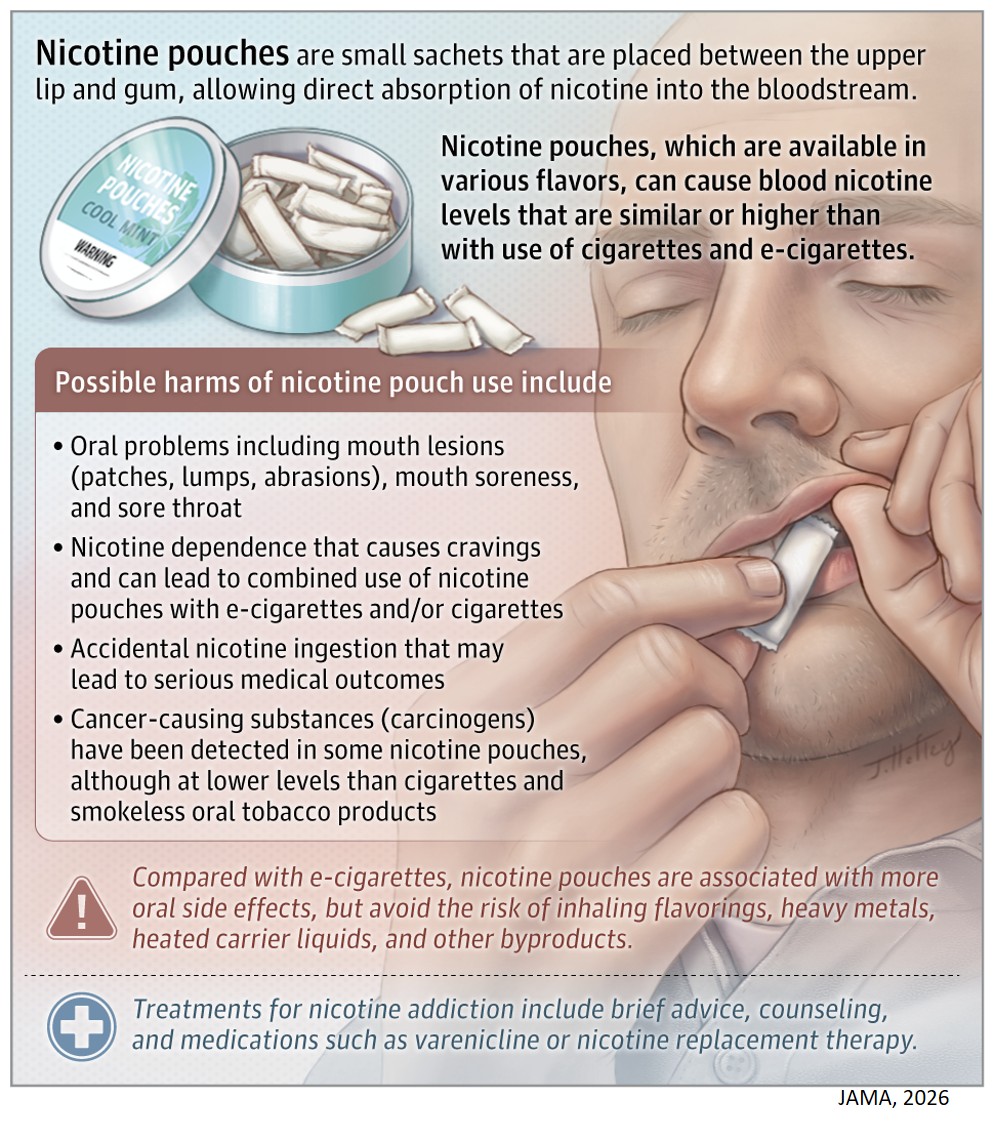 What Are Nicotine Pouches?