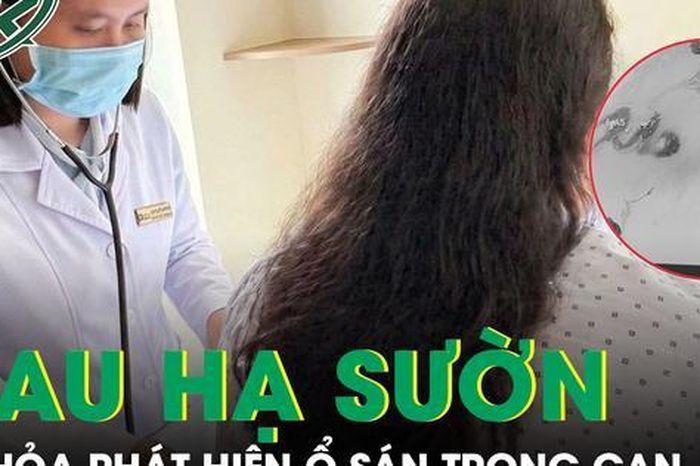 Phát hiện ổ sán làm tổ trong gan từ dấu hiệu đau hạ sườn phải kéo dài - Báo Sức Khỏe &amp; Đời Sống
