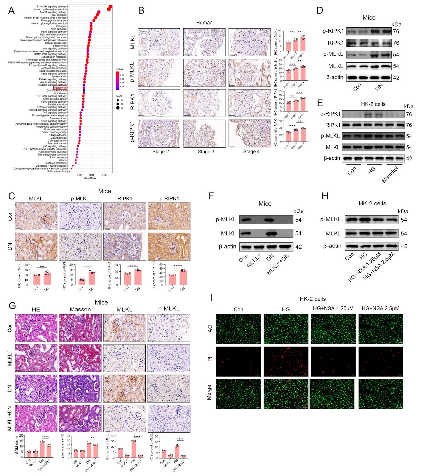 P300-mediated H3K18 acetylation triggers necroptosis via modulation of KRT18 transcription in diabetic nephropathy