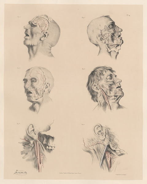 Peculiarities of the branches of the External Carotid arteries 1844
