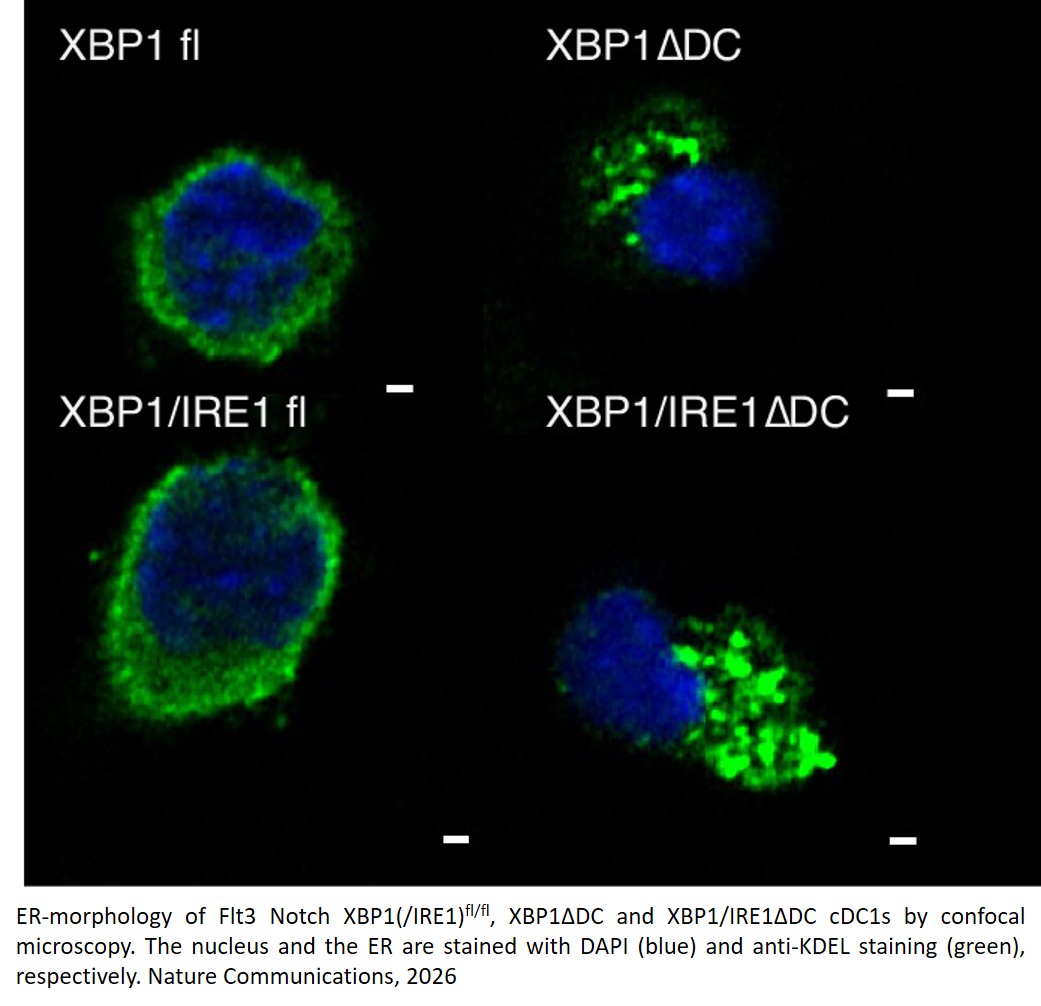 The unfolded protein sensor IRE1 is essential for homeostatic dendritic cell maturation