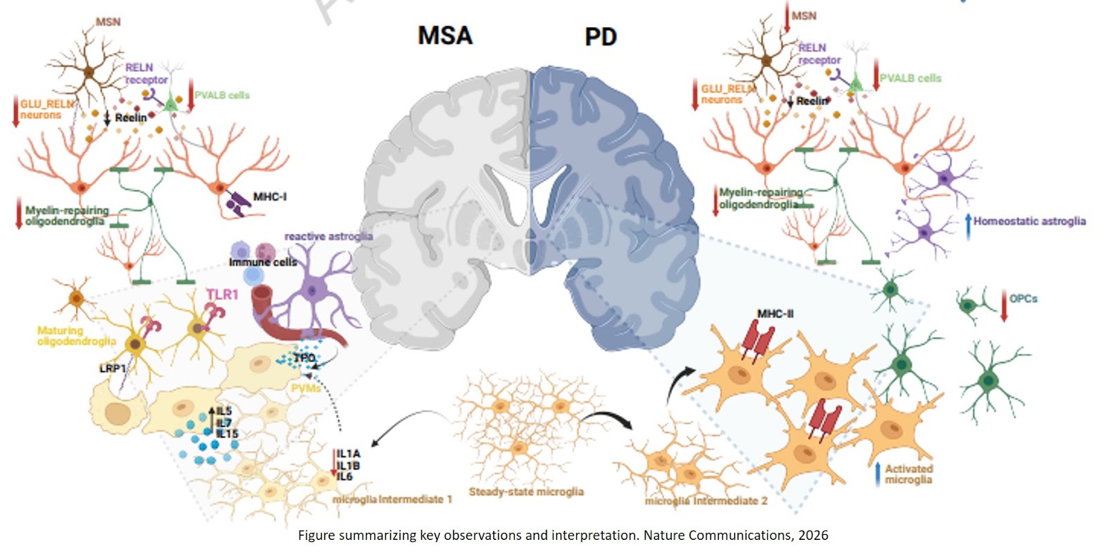 Microglia dysfunction in multiple system atrophy